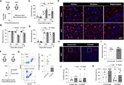Transcriptome Analysis of Microglia Reveals That the TLR2/IRF7 Signaling Axis Mediates Neuroinflammation After Subarachnoid Hemorrhage